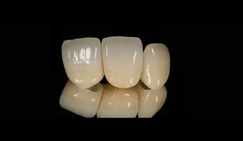 3-leddet tandbro