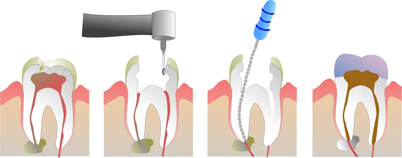 Procedure for rodbehandling