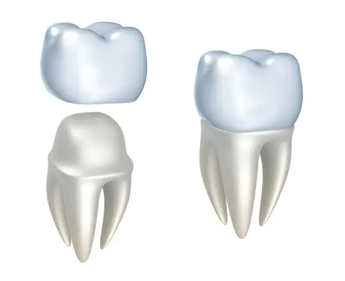 Tandkroner og tand med krone