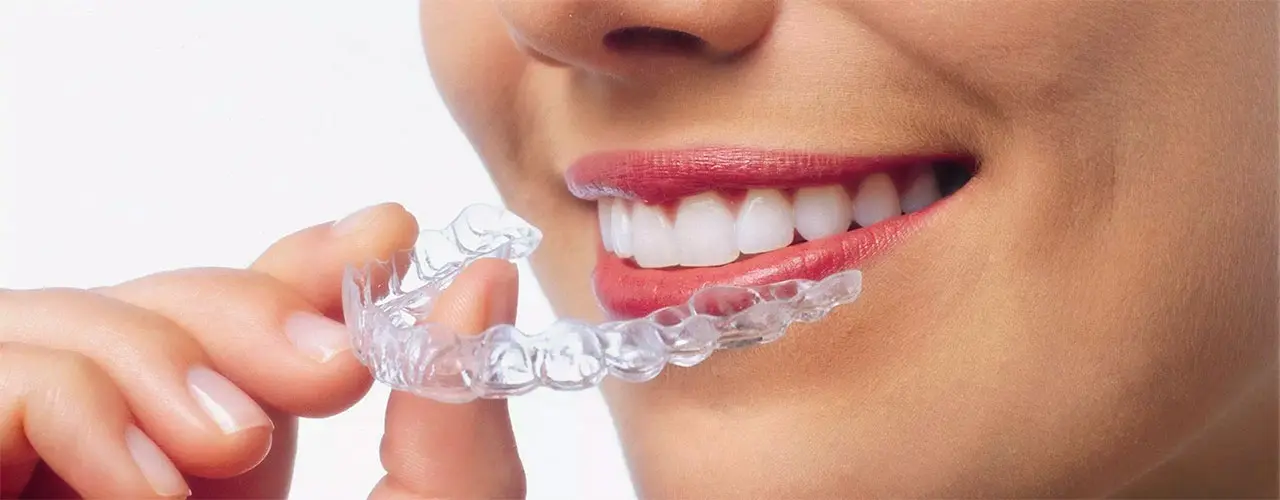Tandretning med Invisalign