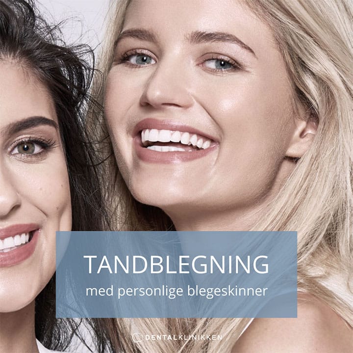 Tilbud på tandblegning i København Tandblegning København K