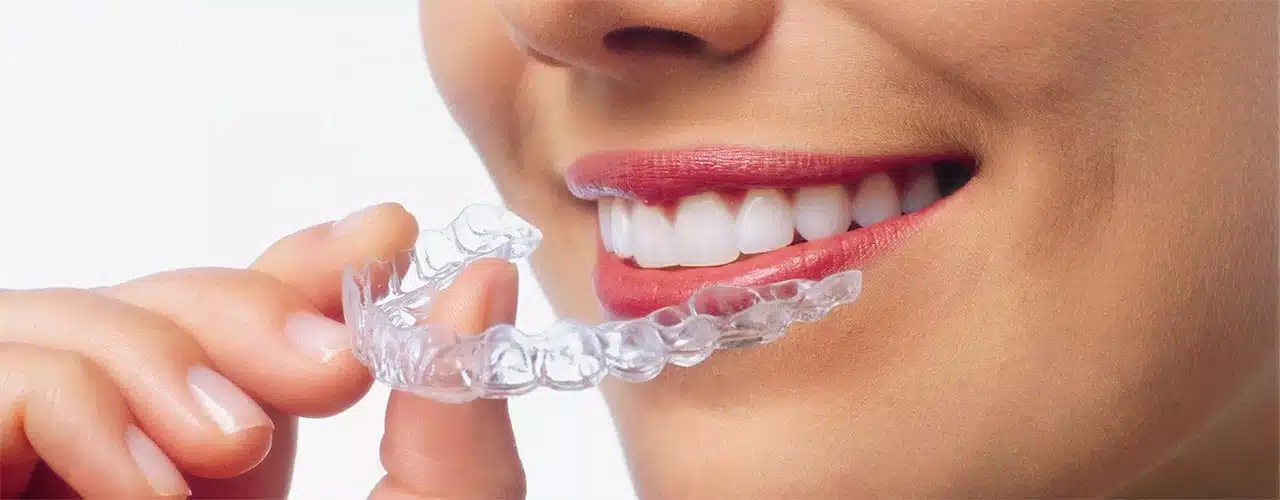 Tandretning med usynlige skinner Tandretning med Invisalign eller ClearCorrect