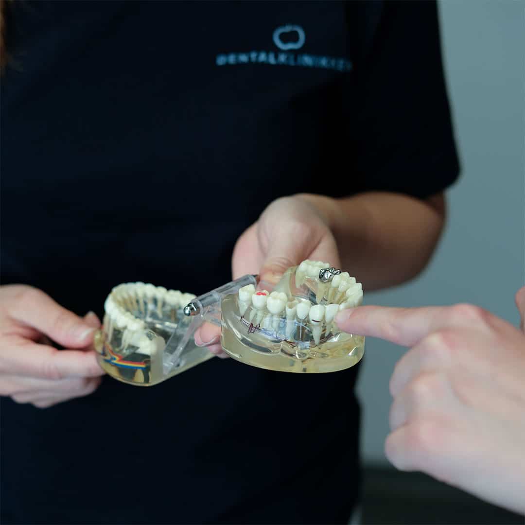 Tandprotese hos tandlæge i Husum