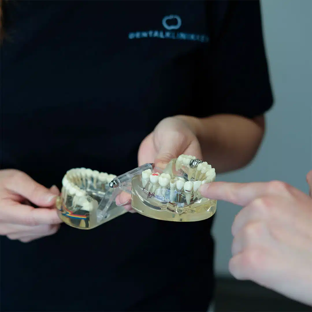 Tandprotese hos tandlæge i Husum